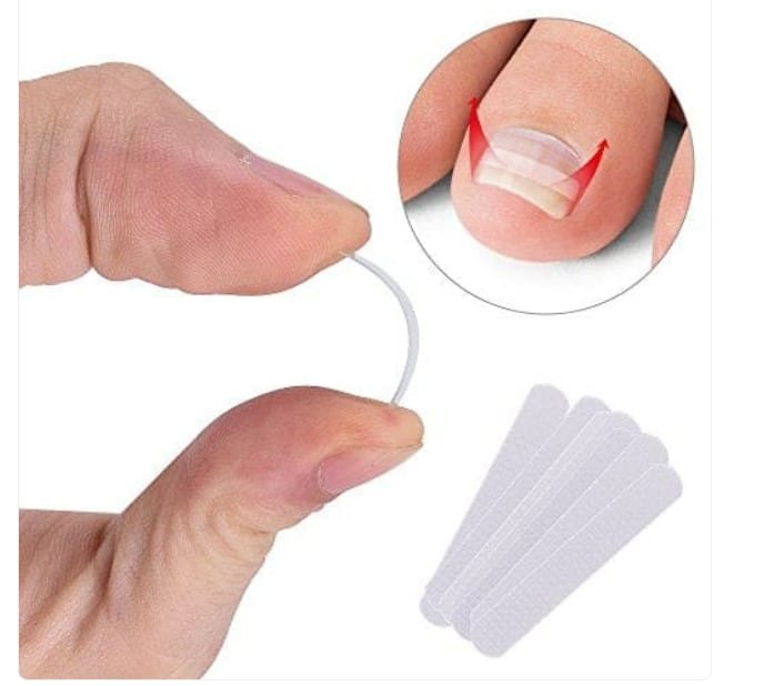 Ingrown Toe nail brace